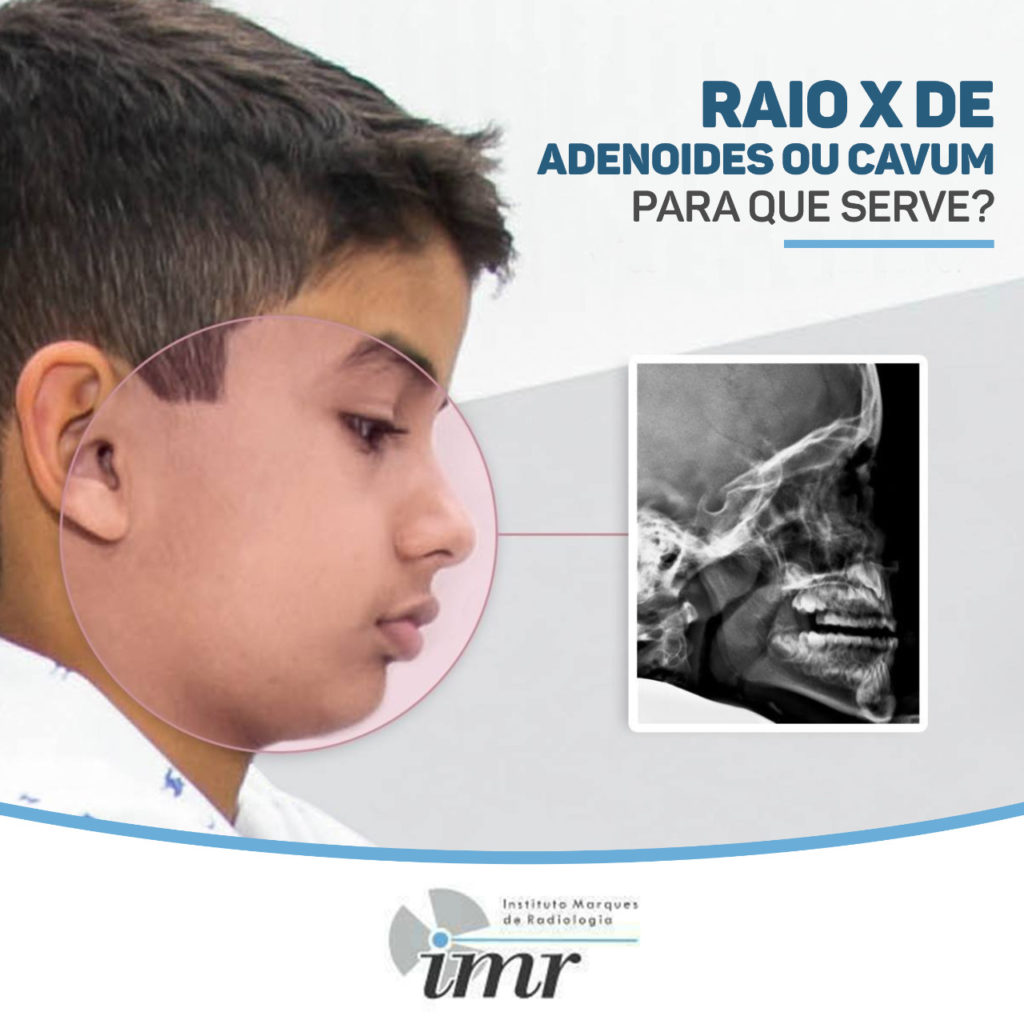 IMR – Instituto Marques De Radiologia