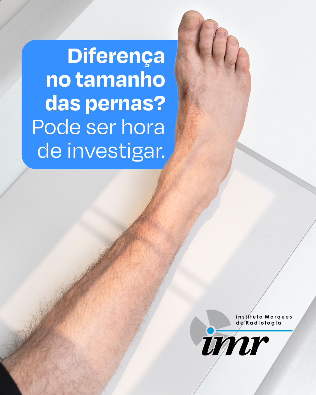 Diferença no tamanho das pernas? Pode ser a hora de investigar